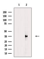 Carbonic Anhydrase VA Antibody in Western Blot (WB)