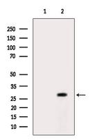 Carbonic Anhydrase VA Antibody in Western Blot (WB)