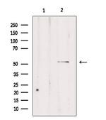 Carboxypeptidase E Antibody in Western Blot (WB)