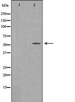 CPN1 Antibody in Western Blot (WB)
