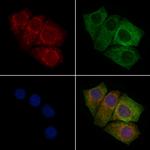 CEP170 Polyclonal Antibody