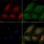 CEP76 Polyclonal Antibody