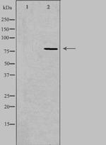 CEP78 Antibody in Western Blot (WB)
