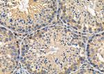 CLCN7 Antibody in Immunohistochemistry (Paraffin) (IHC (P))