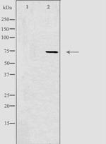 CLIC6 Polyclonal Antibody