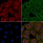 CSGLCAT Polyclonal Antibody