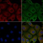 CMTM3 Polyclonal Antibody