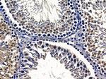 CMTM3 Antibody in Immunohistochemistry (Paraffin) (IHC (P))