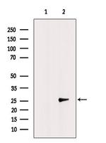 CMTM6 Polyclonal Antibody