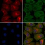 Claudin 19 Polyclonal Antibody