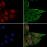 CSTF2T Polyclonal Antibody
