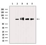 CSTF2T Antibody in Western Blot (WB)