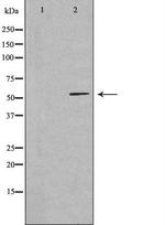 CCDC102A Polyclonal Antibody