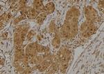 C18orf14 Polyclonal Antibody
