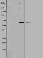 Complement Factor I Polyclonal Antibody