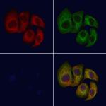 CNGB1 Polyclonal Antibody