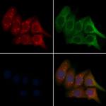 CST11 Polyclonal Antibody