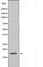 CST11 Antibody in Western Blot (WB)