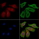 NT5C1A Polyclonal Antibody