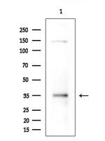 NT5C1A Antibody in Western Blot (WB)