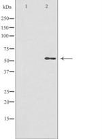 GBA3 Polyclonal Antibody