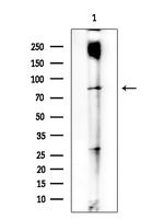 CCP2 Polyclonal Antibody