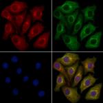 CRMP3 Polyclonal Antibody