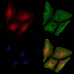 CRMP3 Antibody in Immunocytochemistry (ICC/IF)