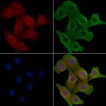 GNPAT Polyclonal Antibody