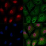 TdT Polyclonal Antibody