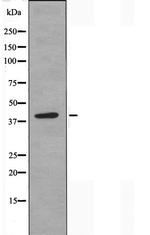 POLR1C Polyclonal Antibody