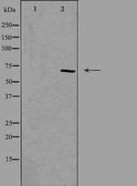TESK1 Polyclonal Antibody