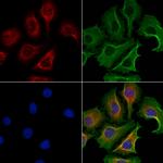 DNAL1 Polyclonal Antibody