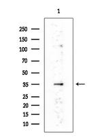 MARCH3 Polyclonal Antibody