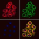 PJA2 Polyclonal Antibody