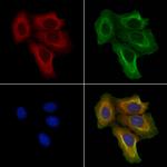 ENTPD1 Antibody in Immunocytochemistry (ICC/IF)