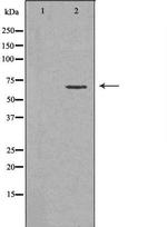 ENTPD1 Antibody in Western Blot (WB)