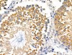 ENDOGL1 Antibody in Immunohistochemistry (Paraffin) (IHC (P))