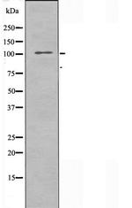 EphA10 Polyclonal Antibody