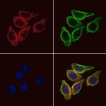 Epsin 3 Polyclonal Antibody