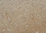 Epsin 3 Antibody in Immunohistochemistry (Paraffin) (IHC (P))