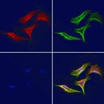 KDELR2 Polyclonal Antibody