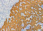 Aldolase B Antibody in Immunohistochemistry (Paraffin) (IHC (P))