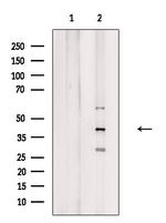 GPS2 Polyclonal Antibody