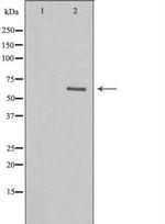 GABRA4 Polyclonal Antibody