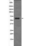 GABRD Polyclonal Antibody