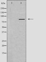 IFI16 Polyclonal Antibody