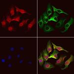 TSTA3 Polyclonal Antibody