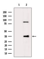 GIMAP5 Polyclonal Antibody