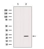 SAR1B Antibody in Western Blot (WB)
